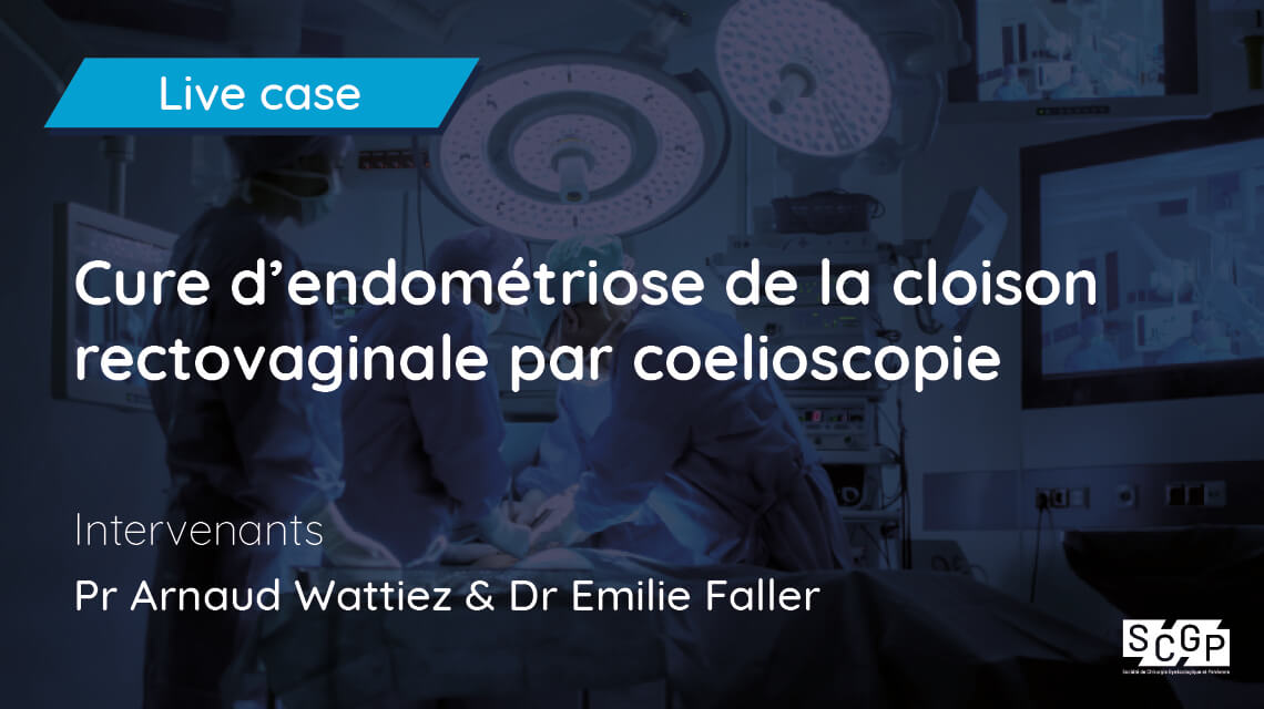Cure d’endométriose de la cloison rectovaginale par coelioscopie