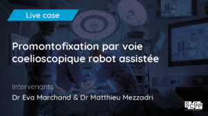 Promontofixation par voie coelioscopique robot assistée
